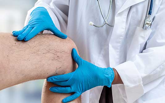 Exemple picture for Clinical trial of cell therapy for osteoarthritis